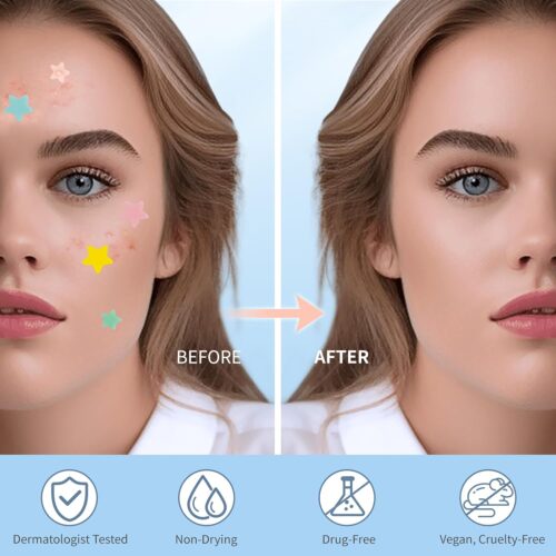 Pimple Patches for Face, Hydrocolloid Acne Patches, Cute Star Zit Covers, Colorful Spot Stickers with Tea Tree, Salicylic Acid & Cica Oil| 3 Sizes (10mm, 12mm & 14mm) |200 Count - Image 4
