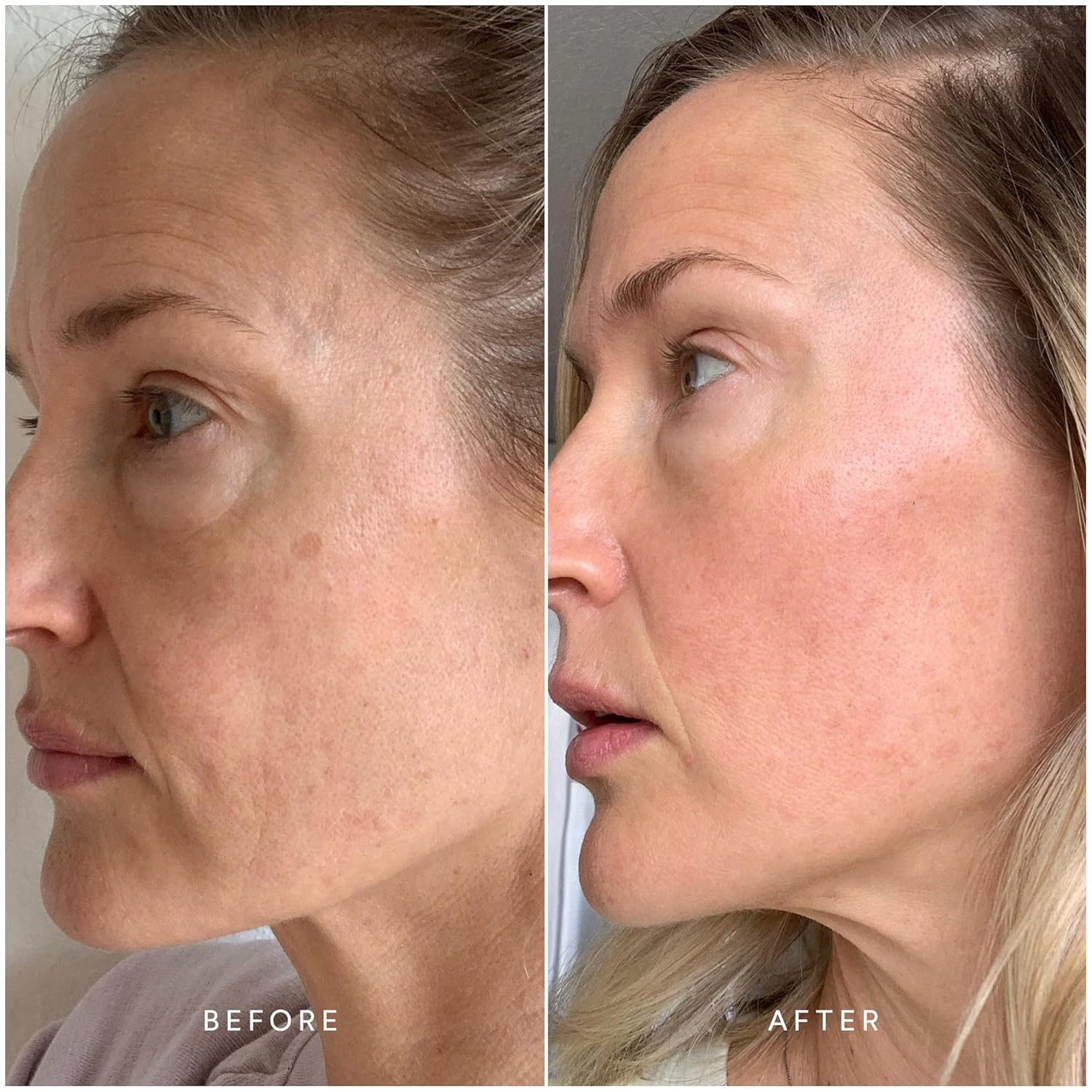 True Botanicals Collagen Boosting Essentials Set |Increase Hydration, Treat Fine Lines & Wrinkles | Contains Ginger Turmeric Cleansing Balm, Chebula Active Serum, & Chebula MultiCorrective Eye Patches - Image 4