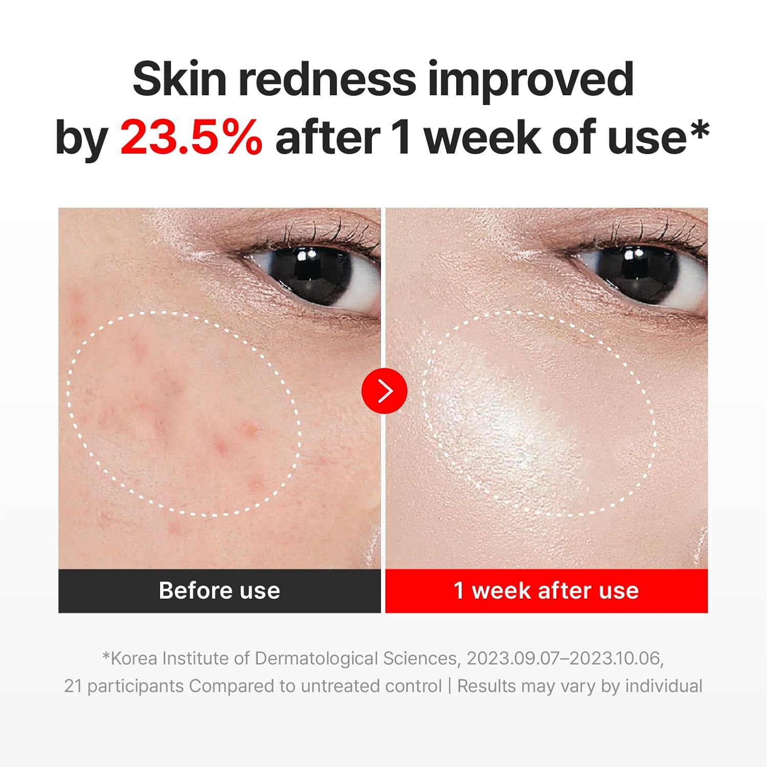 CENTELLIAN 24 Madeca Cream Time Reverse (1.69fl oz) - Advanced Fast-Absorbing & Nourishing, Hydrates, Firms & Reduces Wrinkles, Low Irritation,... - Image 2